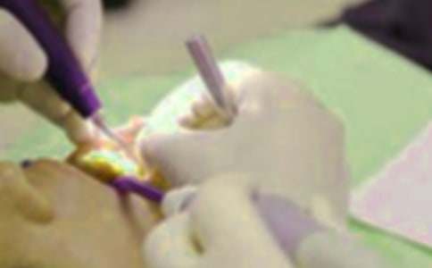 拔牙記作文(15篇)