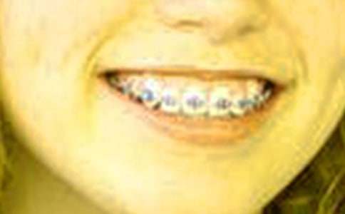 ��t�Ͻ𿾴����׵İ��b�̳�