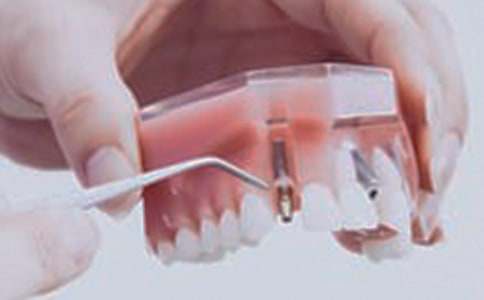 �L�����l�[ʹ��ô�k