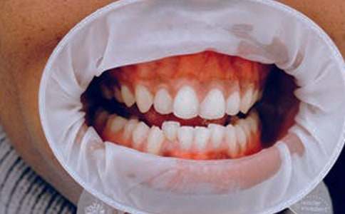 ���������l�[ʹ��ô�k